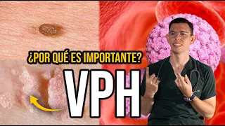 Virus del Papiloma Humano ¿Por qué es IMPORTANTE? |DrPoloGuerrero