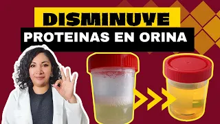 ELIMINA LA PROTEINURIA (proteinas en la orina) con estos CONSEJOS 👩🏻‍⚕️