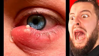 Si Ves Este Video Ganarás 10000 €€€