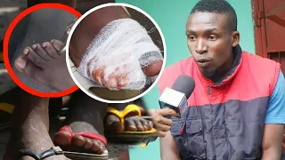Ajutia Baada ya Kukata Kidole Kwa  T sh m45 Adai kupata shida Usiku #zimbabwe @PrinceofZimbabwe
