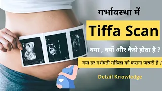 प्रेगनेंसी के 5 वे महीने में Tiffa Scan क्या होता है ? |  Tiffa Scan In 5th Month Pregnancy.