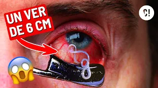 TOP 5 des PIRES PARASITES que tu peux attraper !! 😱