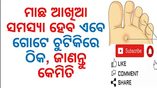 Suffering From Foot Corn? Here is The Solution|Varkha Mohapatra|Odia Health Tips|Home Remedies|Odia