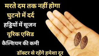 बस 3 बार में ही घुटनो, जोड़ों का दर्द ऐसे खत्म होगा जैसे कभी था ही नहीं  Knee Pain  joint Pain Remedy
