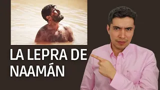 Suelta el orgullo - La lepra de Naamán | Prédicas cristianas | Nicolás Ramos