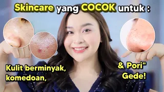 Skincare yang COCOK untuk Kulit Berminyak, Komedoan & Pori" Gede ✨⭐️