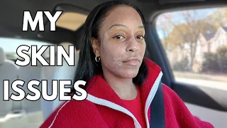 My Skin Issues + Made a New Friend in my New Neighborhood + My Fiancé Says I Don’t Spend Time w/Him