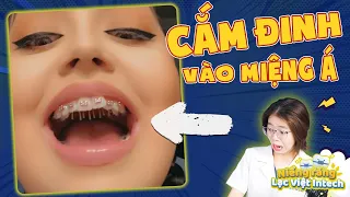 Có Nên Tẩy Trắng Răng Khi Niềng, Rào Ngăn Đẩy Lưỡi | Reaction Video Hot| Lạc Việt Intech Niềng Răng