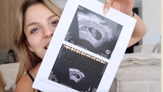 JE SUIS ENCEINTE DE NOTRE DEUXIÈME BÉBÉ