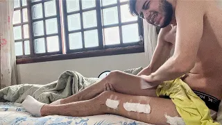 como estou vivendo com as PERNAS QUEBRADAS?