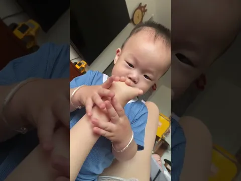Người mẹ bị dị tật ở bàn tay
