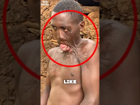 What Happened To His Face?! 😰🥺