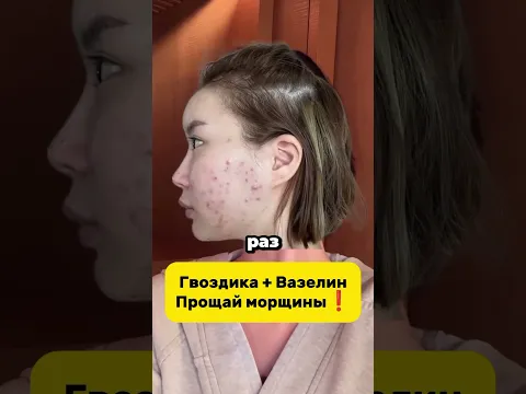 Гвоздика + Вазелин -10лет маска от морщин #маска #домашнийуход