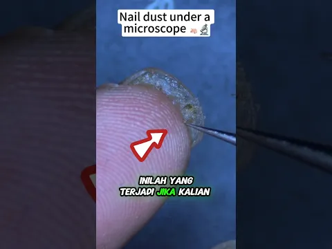 Ternyata Ini Didalam Kotoran 😱