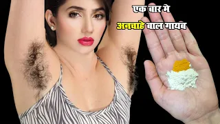 इससे 5 मिनट में अनचाहे बाल ऐसे हटेंगे जैसे कभी थे ही नहीं, Remove Anchahe Baal
