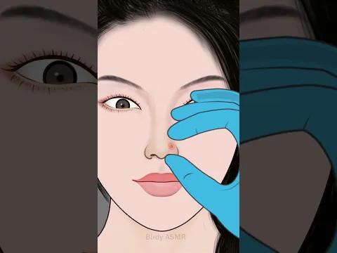 ASMR Remove Unmanaged nose piercing #asmr #shorts #viral #youtubeshorts