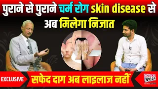 पुराने से पुराने चर्म रोग, सफेद दाग से अब मिलेगा निजात, skin disease treatment, Dr. Mahendra Kabra.