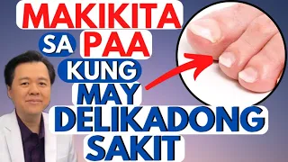 Makikita sa Paa kung may Delikadong Sakit. - By Doc Willie Ong (Internist and Cardiologist)