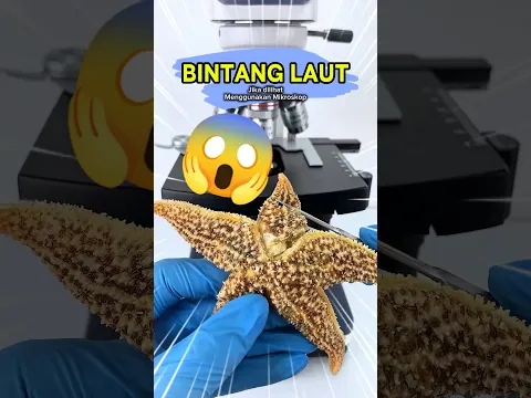 JANGAN DISENTUH! 🛑 Ternyata Bintang Laut Itu "Apartemen" Kuman?! 🤮🦠
