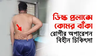 ডিস্ক প্রলাপ্সে কোমর বাঁকা রোগীর অপারেশন বিহীন চিকিৎসা