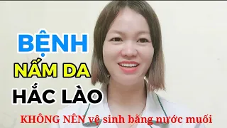 Bệnh Nấm Da, HẮC LÀO Có Được vệ sinh bằng nước muối không?