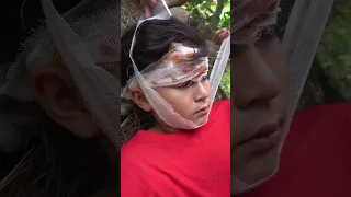 ACR - Survival Skills In Forest | SIMPLE but USEFUL #survival #bushcraft #forest #outdoors #shorts