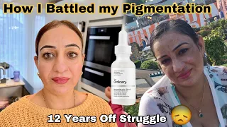 ❗️How I Cured Facial Pigmentation The Most Difficult 12 Years In My Life! 😓Sharing is Kindness 👉