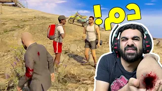 انقصت يدي بسبب قراند🩸🙁
