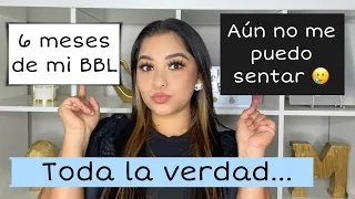 Todo sobre mi Cirugía BBL, Preguntas y respuestas de mi Liposucción 360 con transferencia de grasa