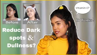 Reduce Dark Spots & Dullness | Amazing Benefits of Vitamin C Serum - How To Use? | Glory Gust
