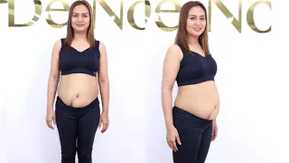 Su Pan Htwar's Liposuction Video