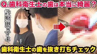 【虫歯】歯科衛生士の口の中は本当に綺麗？歯医者が抜き打ちチェック！