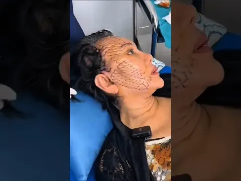 Actress Plastic Surgery Gone Wrong #shorts #shortsfeed #trendingshorts #viralshorts