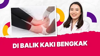 Penyebab dan Pengobatan Kaki bengkak
