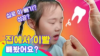 치과 안 가고 이빨 뺐어요! 실로 뺀 체라의 리얼 반응ㅋㅋ [루루체체 TV]