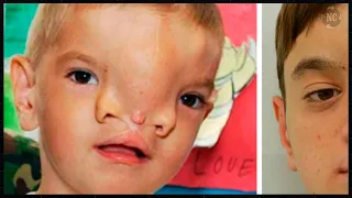Lembra do MENIN0 com uma FENDA no R0ST0 descoberto por um S0LDAD0? Ele está IRREC0NHECÍVEL!