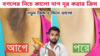 বগলের নিচে কালাে দাগ দূর করার ক্রিম,kalo bogol forsa korar upay@cpdrubelmia5966