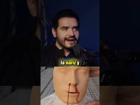 ❗️Me S4NGR4 la NARIZ ¿CÓMO controlarlo? #Shorts