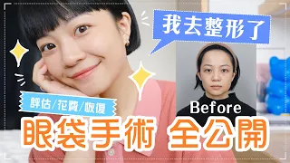 我偷偷整形了🤫淚溝掰掰！價錢診所大公開！麻醉小插曲？連肚臍也抽脂？