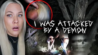 I WAS SCRATCHED AT THE DEVIL'S OAK TREE (BODY DUMPING GROUND)