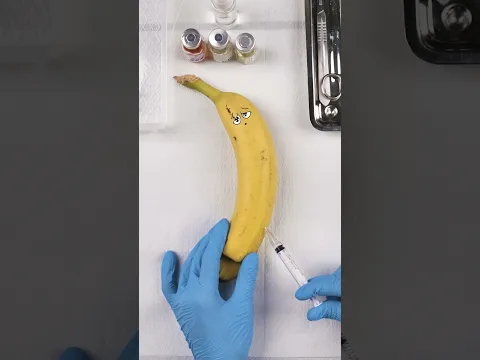 Stepped on banana needs emergency surgery! 🍌💉