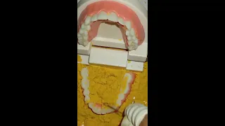 ⚙️🦷👄