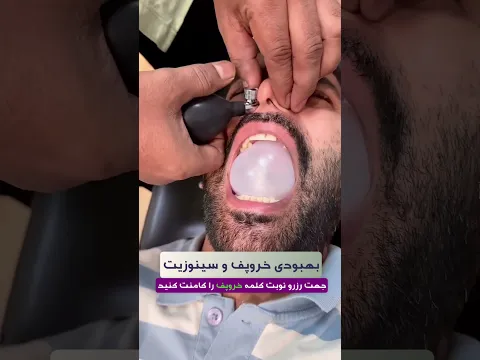 درمان خروپف بدون جراحی