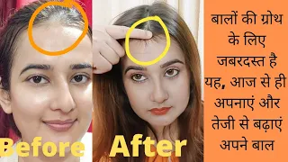 90 Days Hair Growth Transformation Challenge| Use this Hair Supplement & Stop hair Loss| SWATI