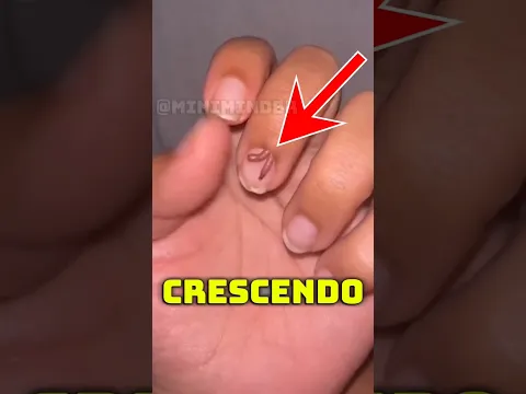 Se isso aparecer no seu dedo, CORRA para um hospital! 😨❗#shorts  #coelho #dedo #unha #amor