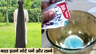 गारंटी लेती हूँ 3 दिन में भयंकर लंबे,घने बाल होजाएँगे इतने बढ़ेंगे की कटवाने पड़ेंगे Long Hair
