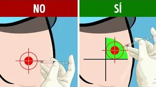 Como Aplicar Inyección Intramuscular en el GLUTEO 🍑