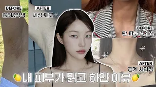 (eng) 언니 피부 어떻게 하얘졌어요?🍋 + 찐으로 효과본 미백템들, 겨드랑이 착색 관리템, 탄 피부 되돌리는 법✨ | 소윤Soyoon