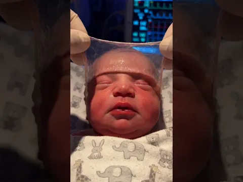 First Moments of Life 💕 #shorts