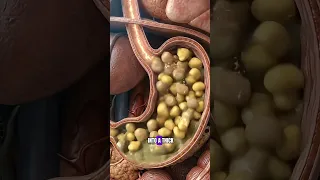 What Really Happens Inside Your Body When You Avocado Toast?  #humanbody #anatomy #shorts